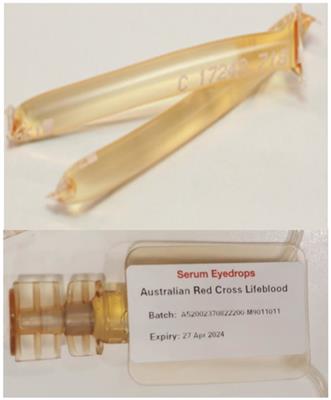 Patient-reported outcomes of serum eye drops manufactured from Australian blood donations and packaged using Meise vials